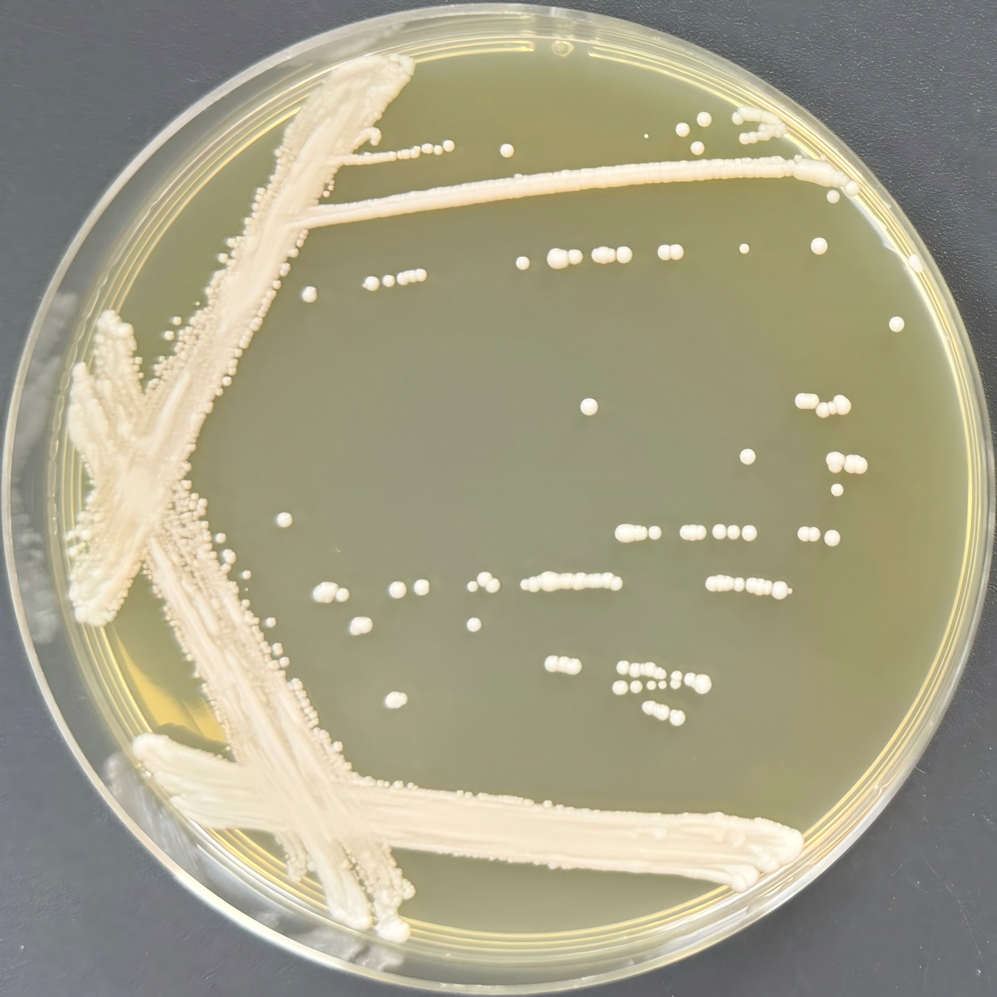Brewing yeast-BNCC