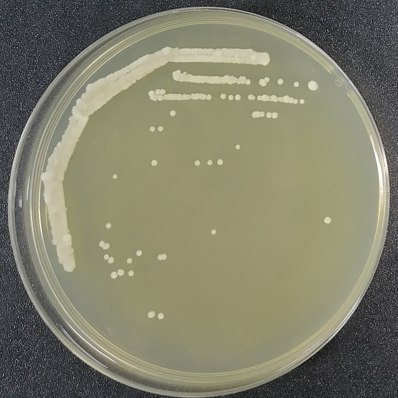 Saccharomyces cerevisiae-BNCC
