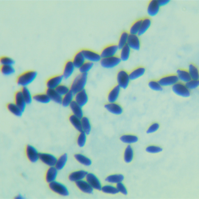 Saccharomyces cerevisiae-BNCC