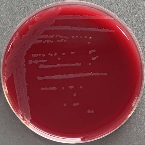Clostridium-BNCC