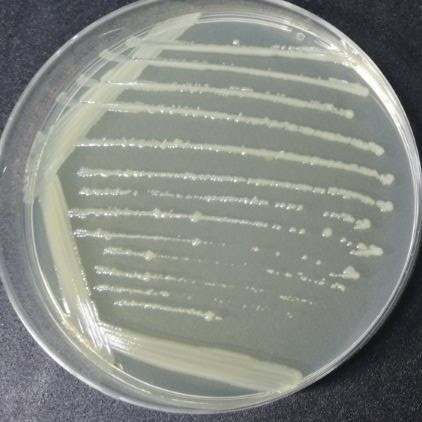 Escherichia coli-BNCC