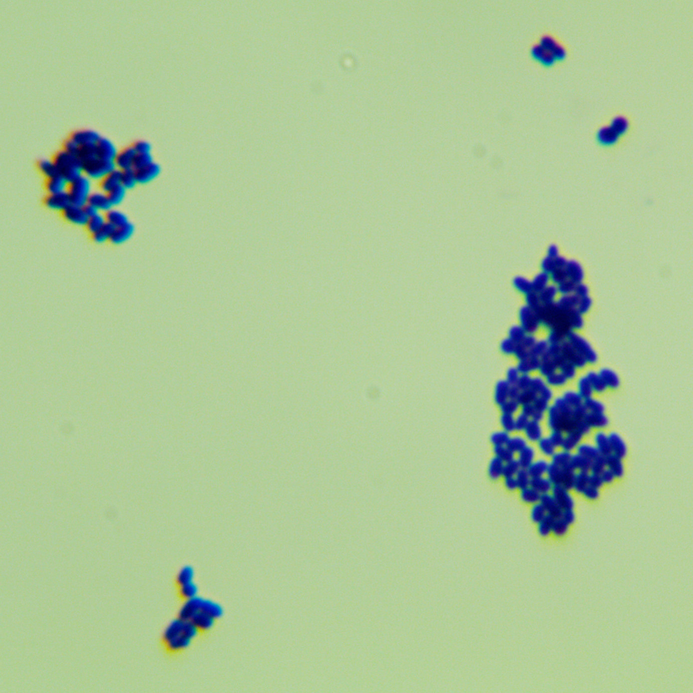 Corynebacterium glutamicum type I-BNCC