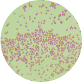 Escherichia coli-BNCC