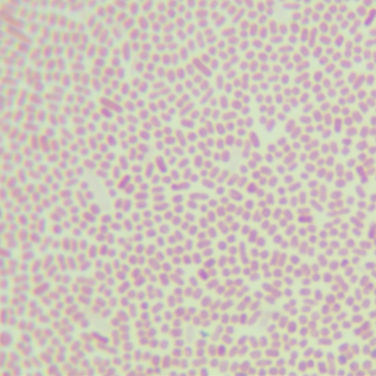 Escherichia coli-BNCC