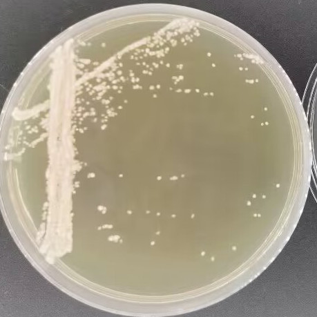 Capsule-forming yeast-BNCC