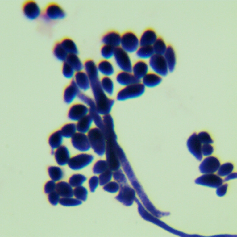 Capsule-forming yeast-BNCC
