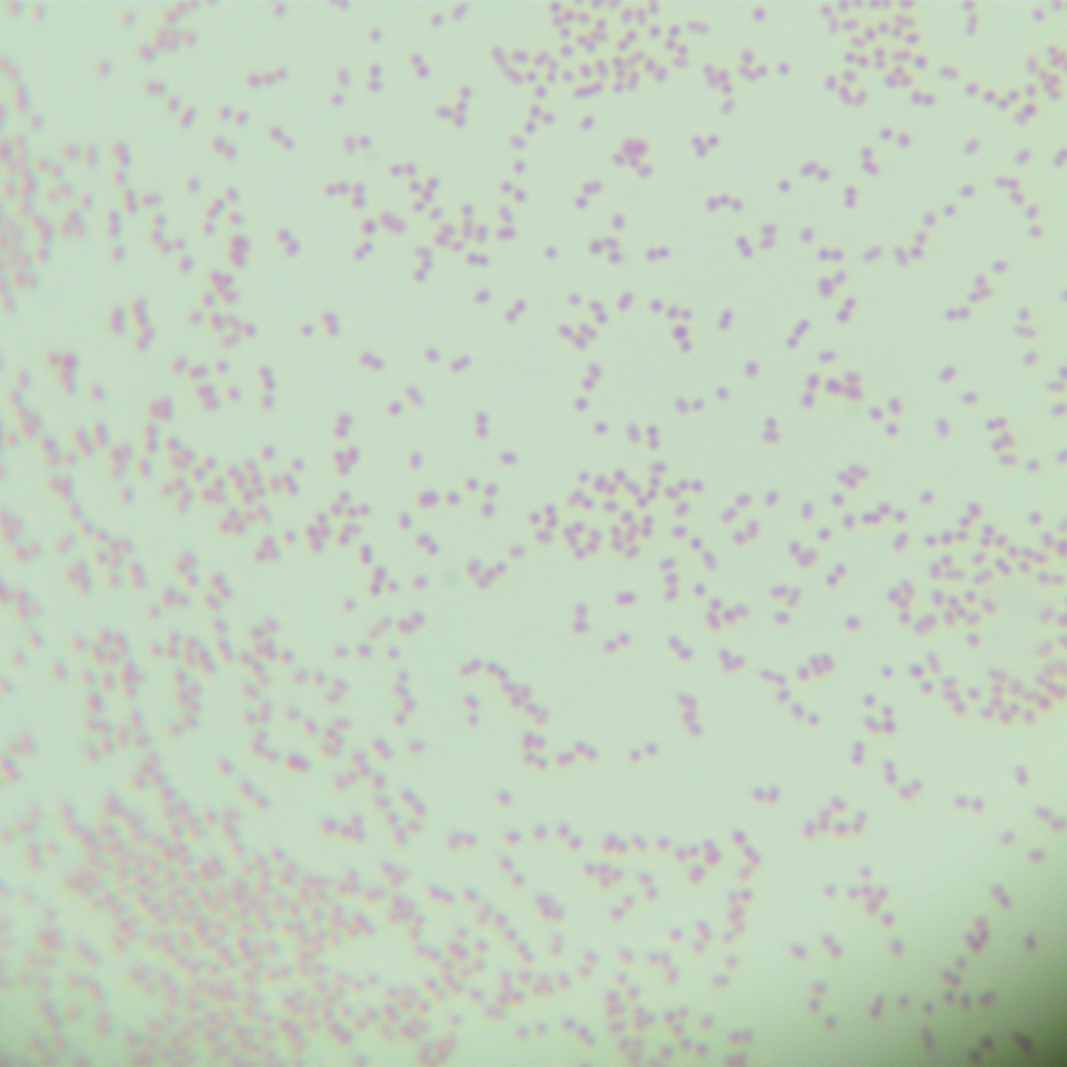 Fecal alkali producing bacteria-BNCC