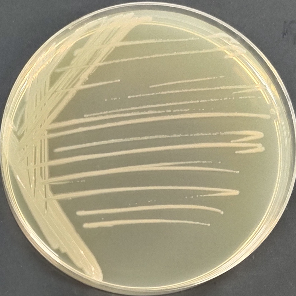 Fecal alkali producing bacteria-BNCC