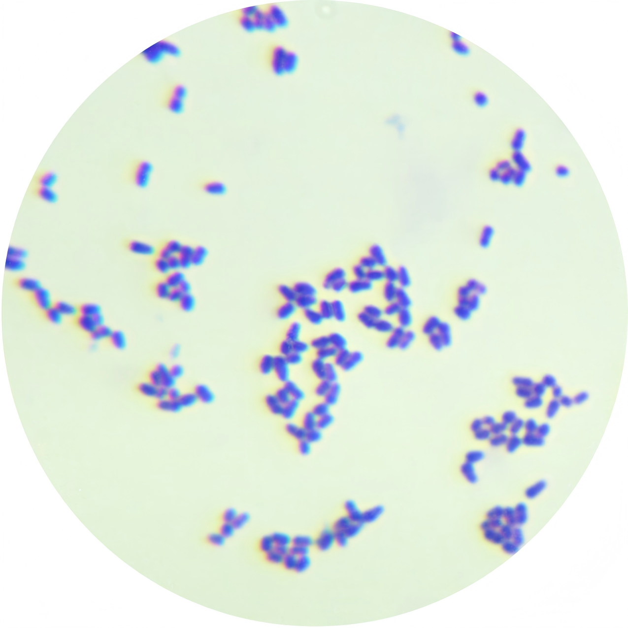 Corynebacterium glutamicum-BNCC