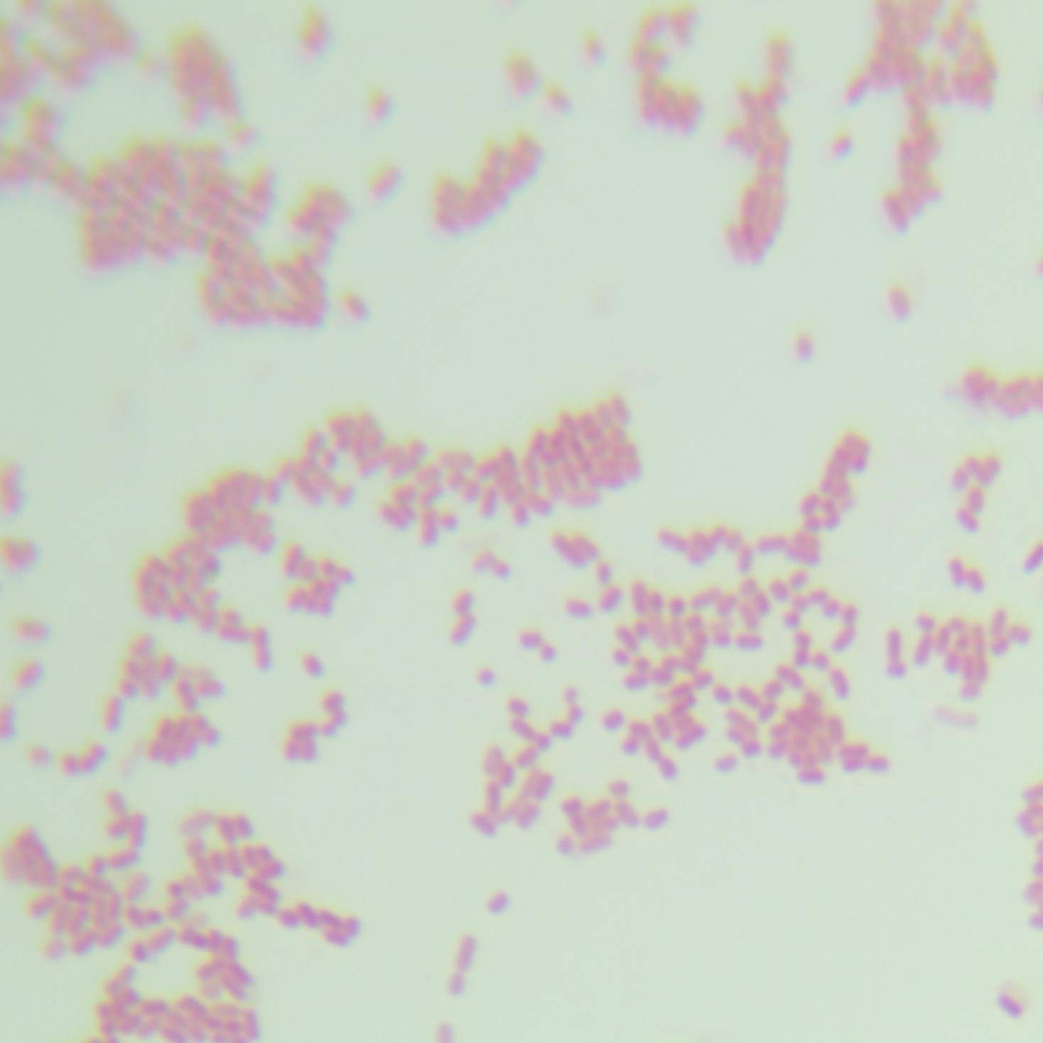 Hemorrhagic Escherichia coli O157: H7-BNCC