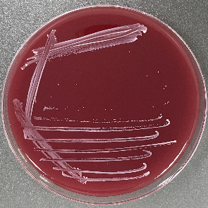 Propionibacterium acnes (Propionibacterium acnes, Propionibacterium acnes)-BNCC