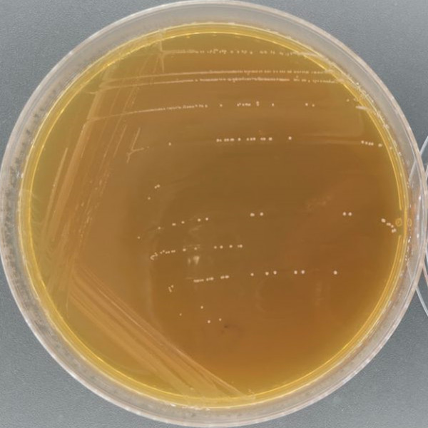 Bifidobacterium animalis subsp. lactis-BNCC