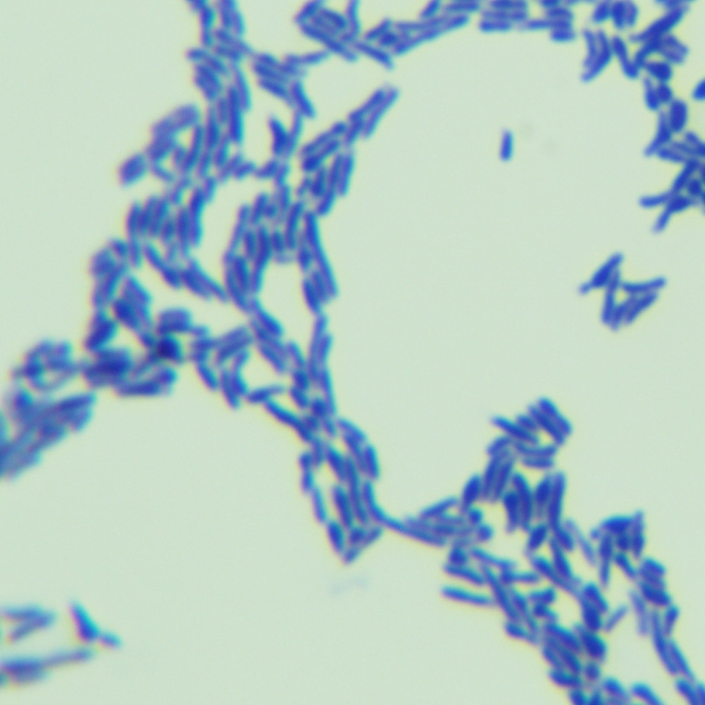 Bifidobacterium animalis subsp. lactis-BNCC
