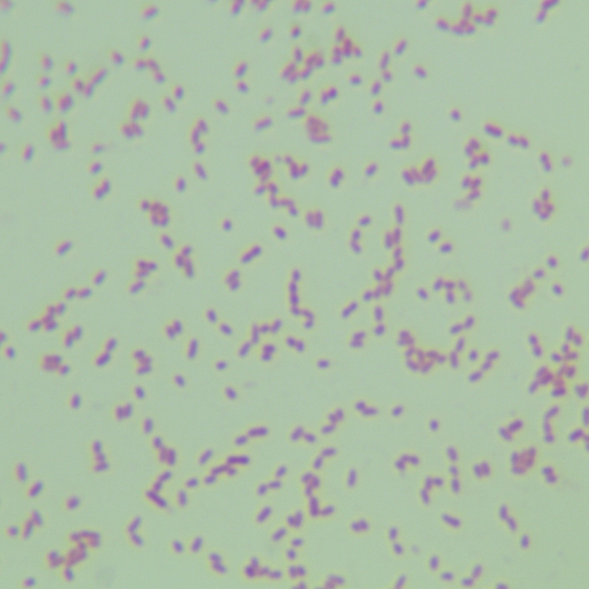 Pseudomonas aeruginosa-BNCC