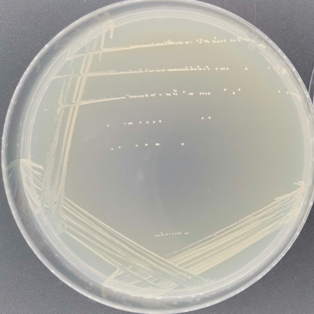 Jensen's Propionibacterium-BNCC