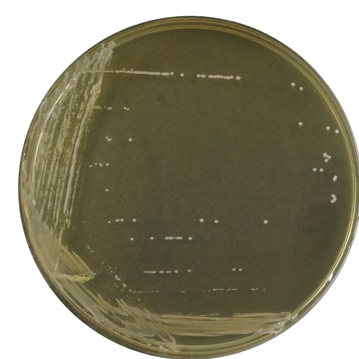 Lactobacillus salivarius-BNCC