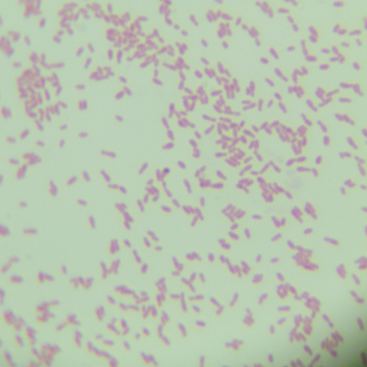 Radiation type rhizobia-BNCC