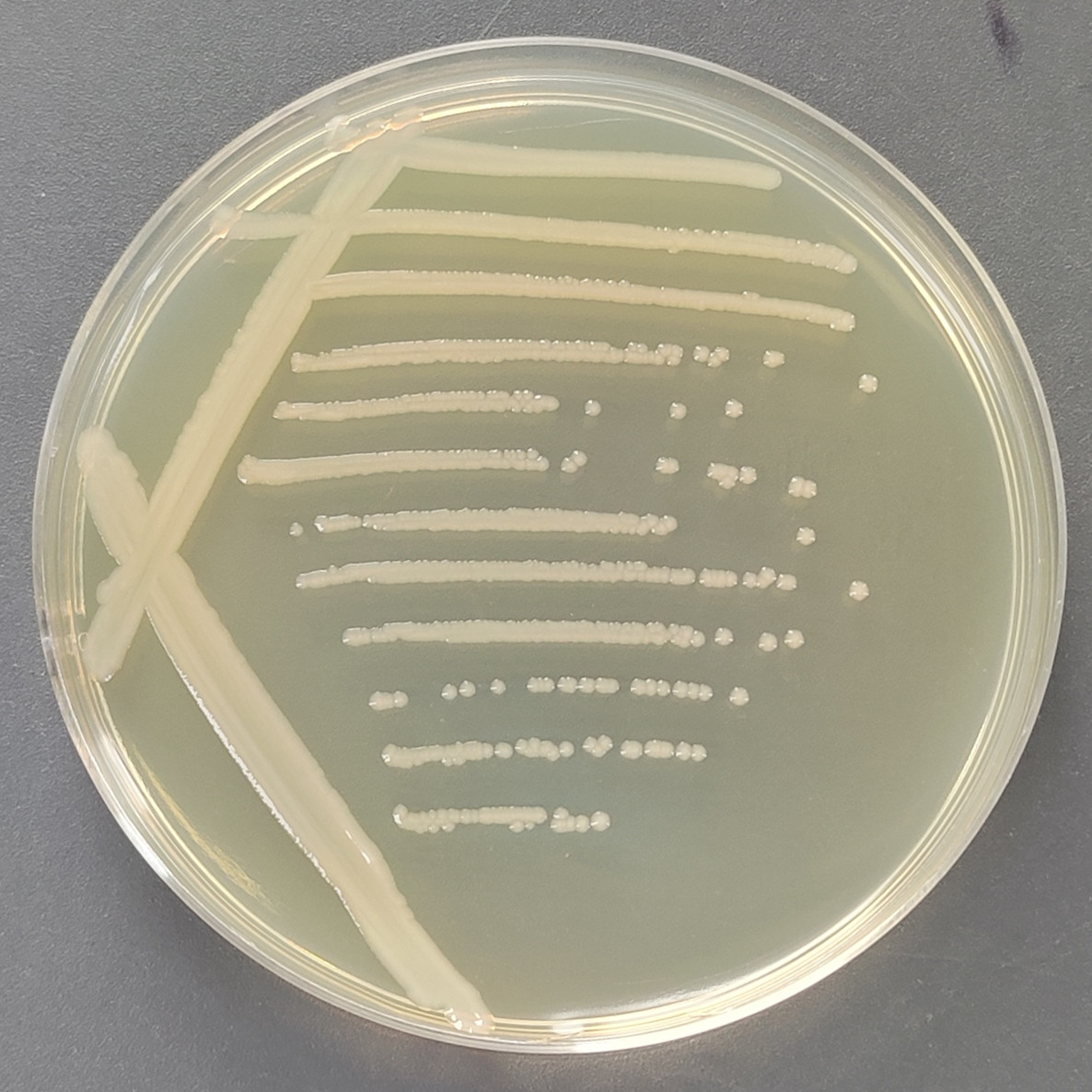 Escherichia coli-BNCC