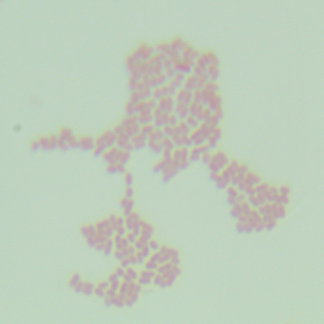 Escherichia coli-BNCC