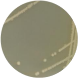 Enterotoxigenic Escherichia coli-BNCC