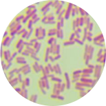 Enterotoxigenic Escherichia coli-BNCC