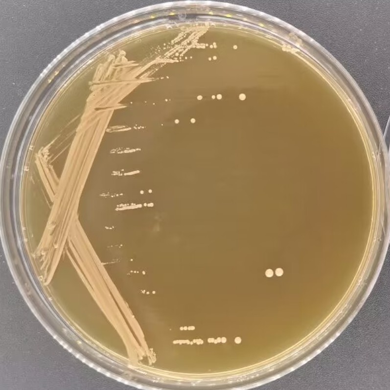 Lactobacillus paracasei subsp. paracasei-BNCC