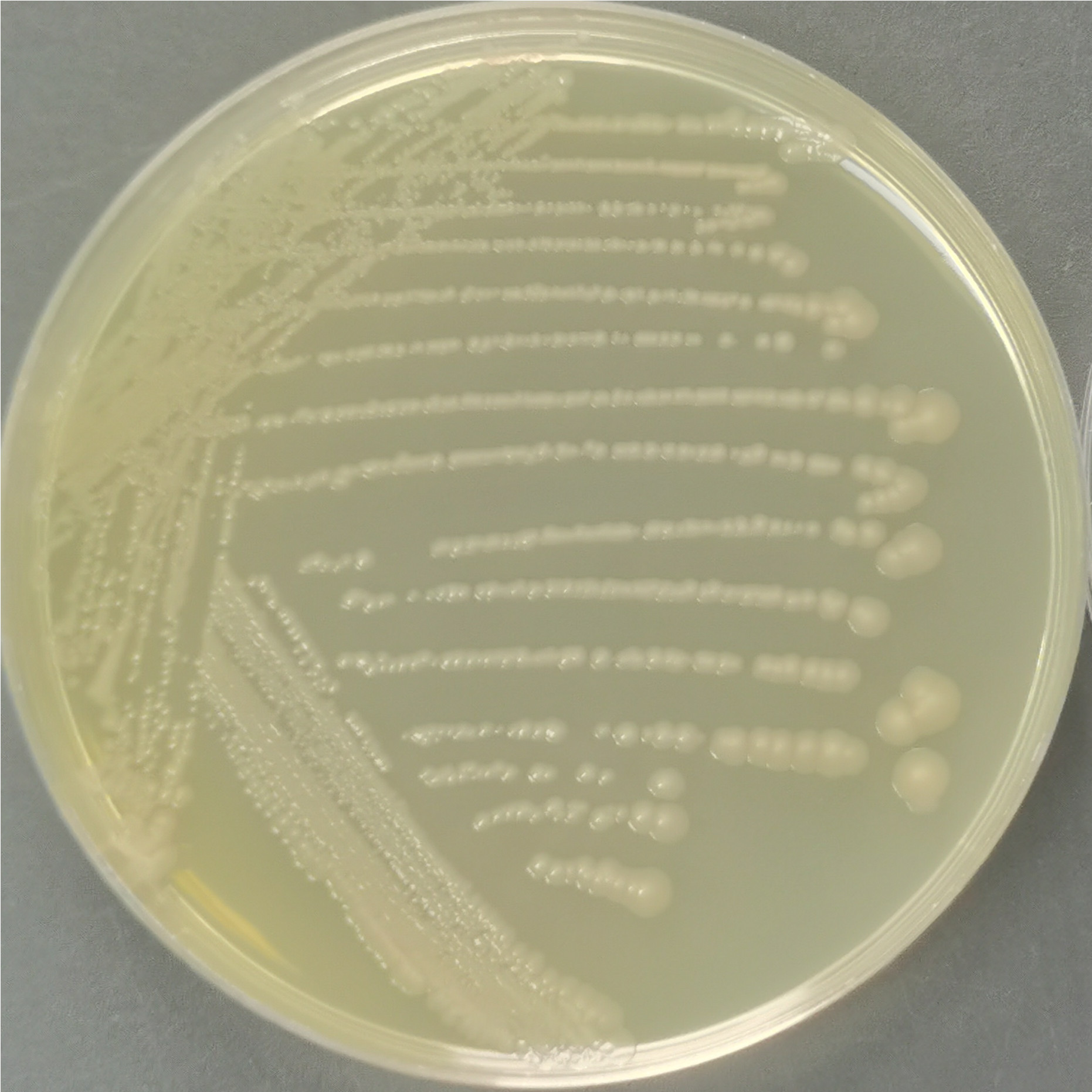 Escherichia coli (including Clostridium botulinum type E gene)-BNCC