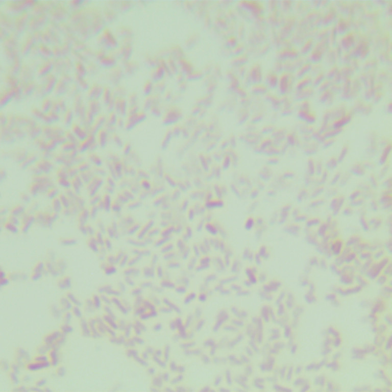 Escherichia coli (including Clostridium botulinum type E gene)-BNCC