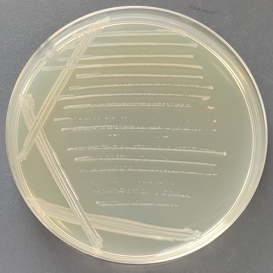 Escherichia coli (including Clostridium botulinum type A gene)-BNCC
