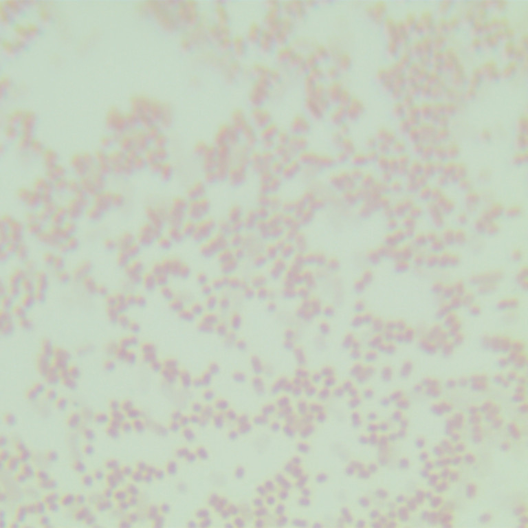Escherichia coli (including Clostridium botulinum type A gene)-BNCC