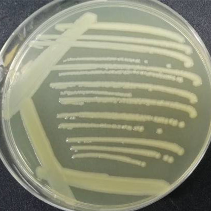 Shortwave Pseudomonas aeruginosa-BNCC