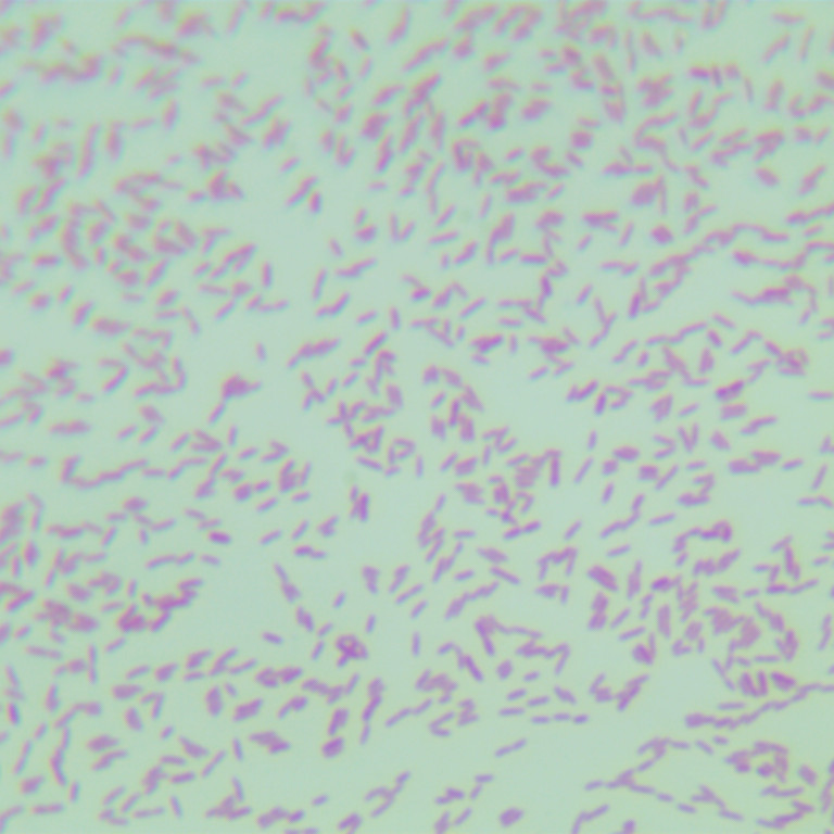 Shortwave Pseudomonas aeruginosa-BNCC