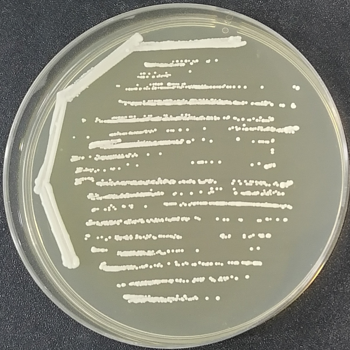 L-type yeast-BNCC
