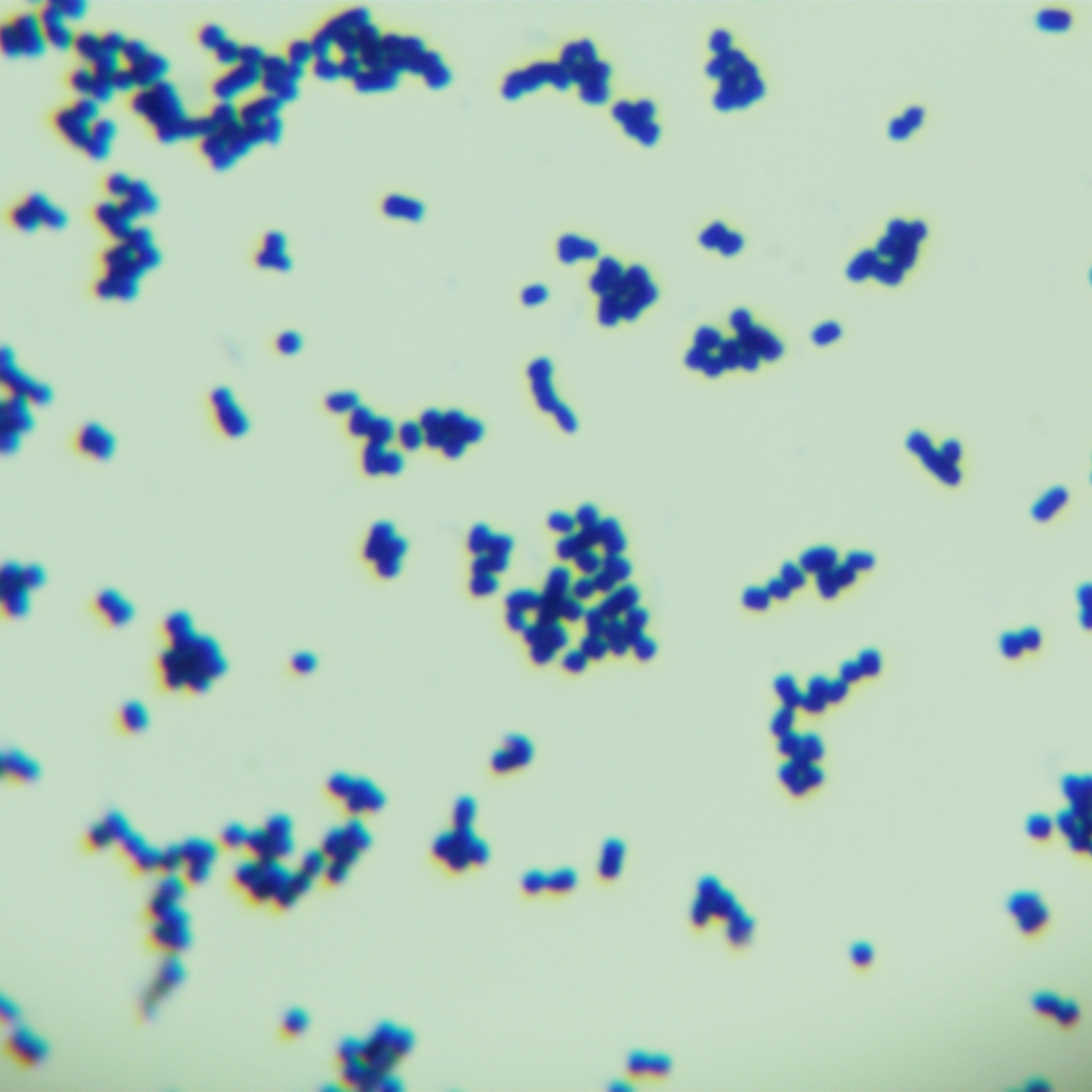 Intermediate type Streptomyces-BNCC