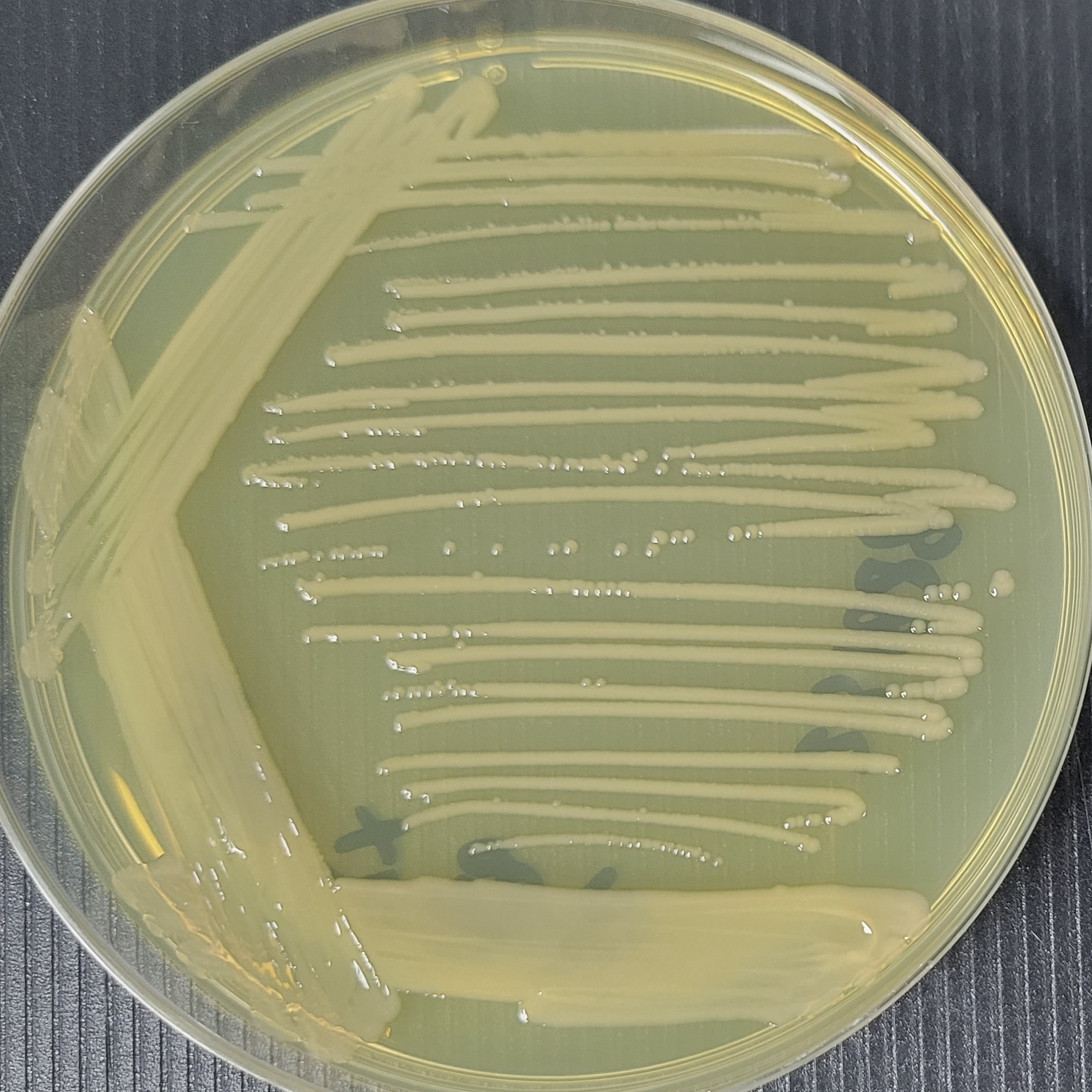 Pseudomonas aeruginosa orange subspecies-BNCC