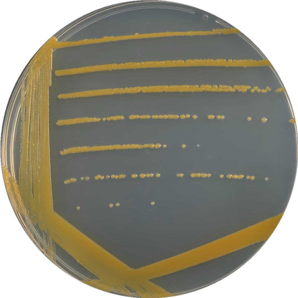Alaska Sphingosine Box Bacteria-BNCC