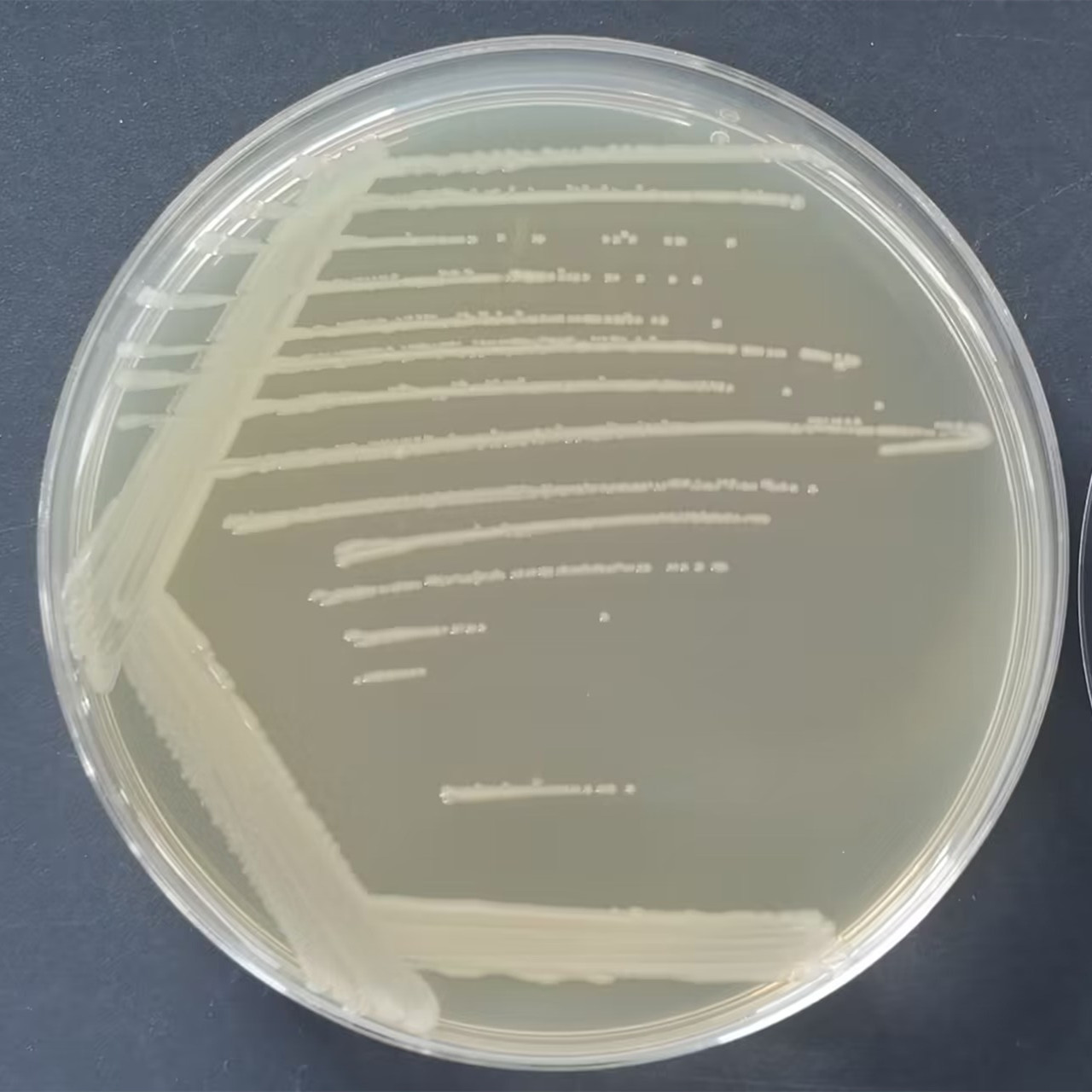 Shigella dysentery-BNCC