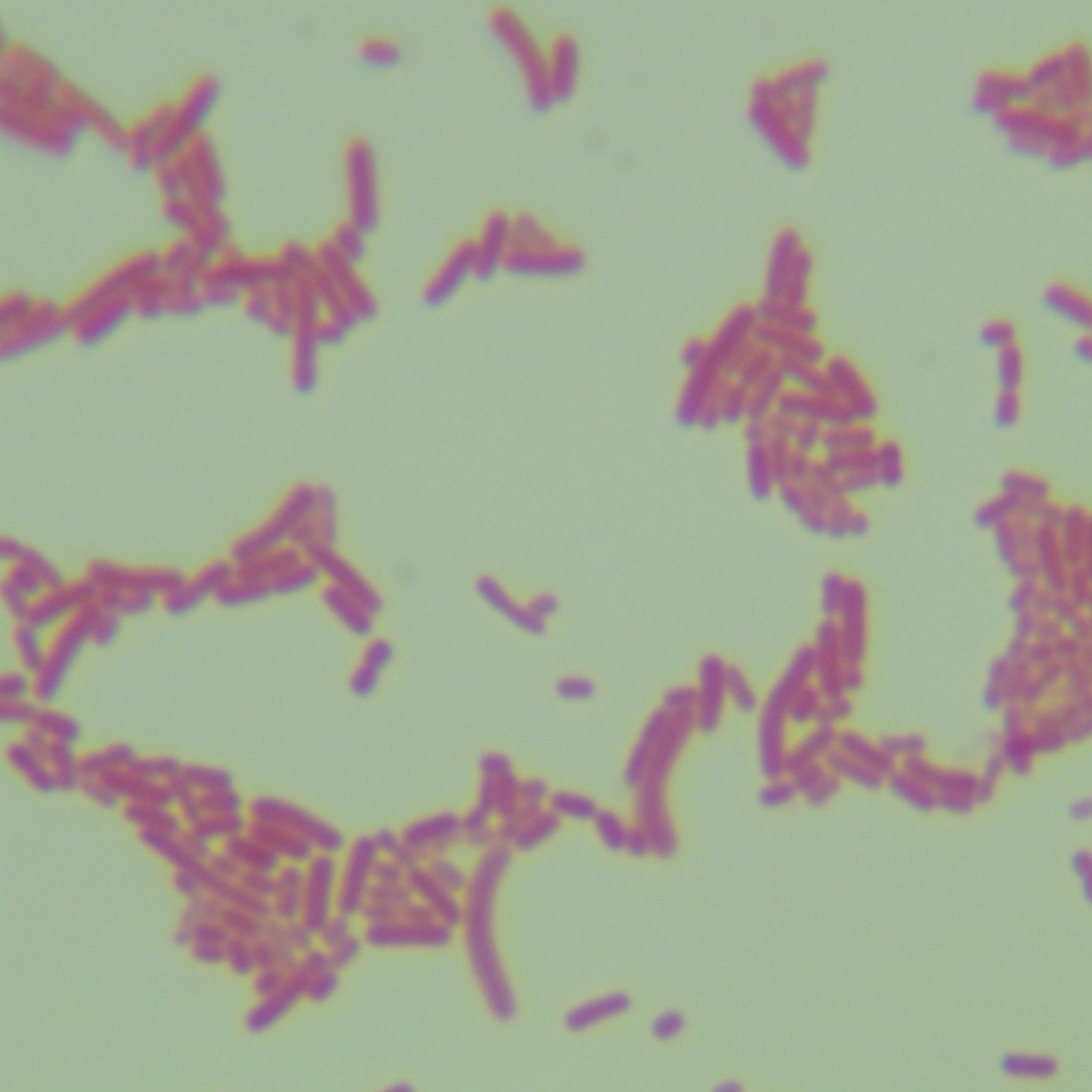 Shigella dysentery-BNCC