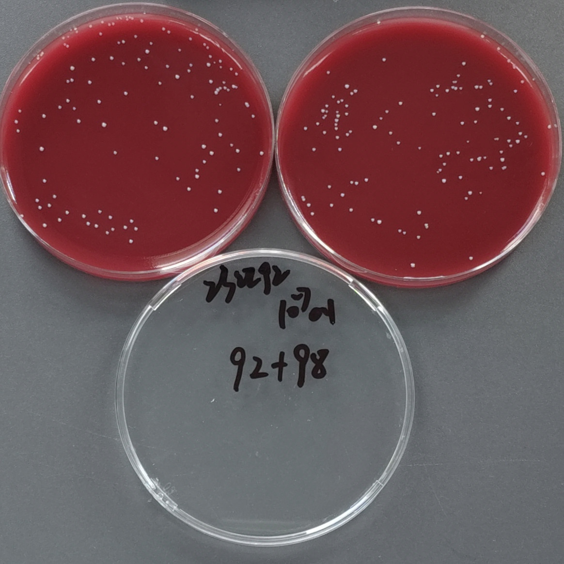 Fecal Bacteroidetes-BNCC