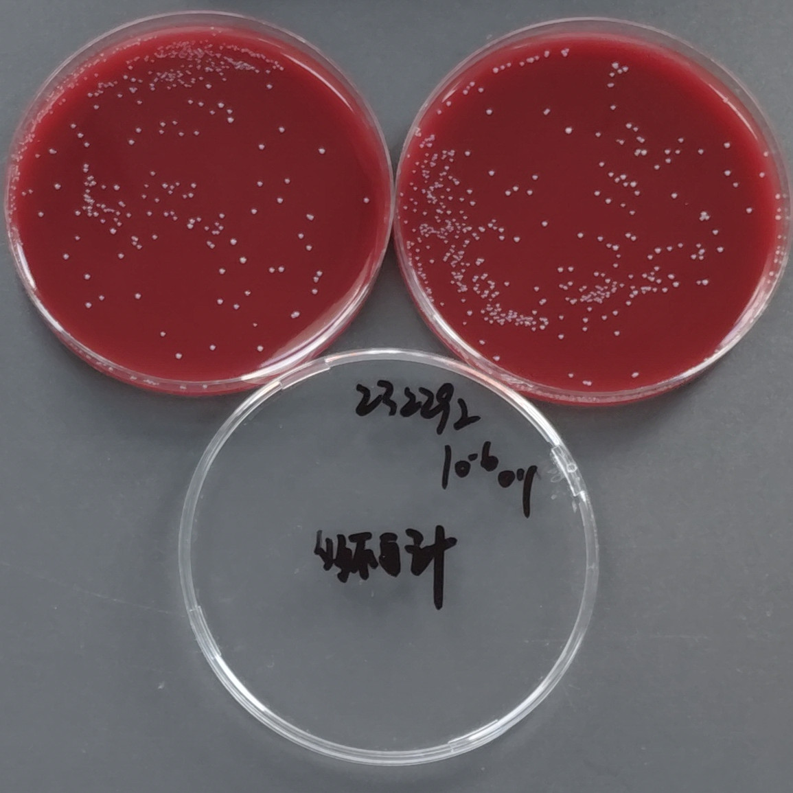 Fecal Bacteroidetes-BNCC