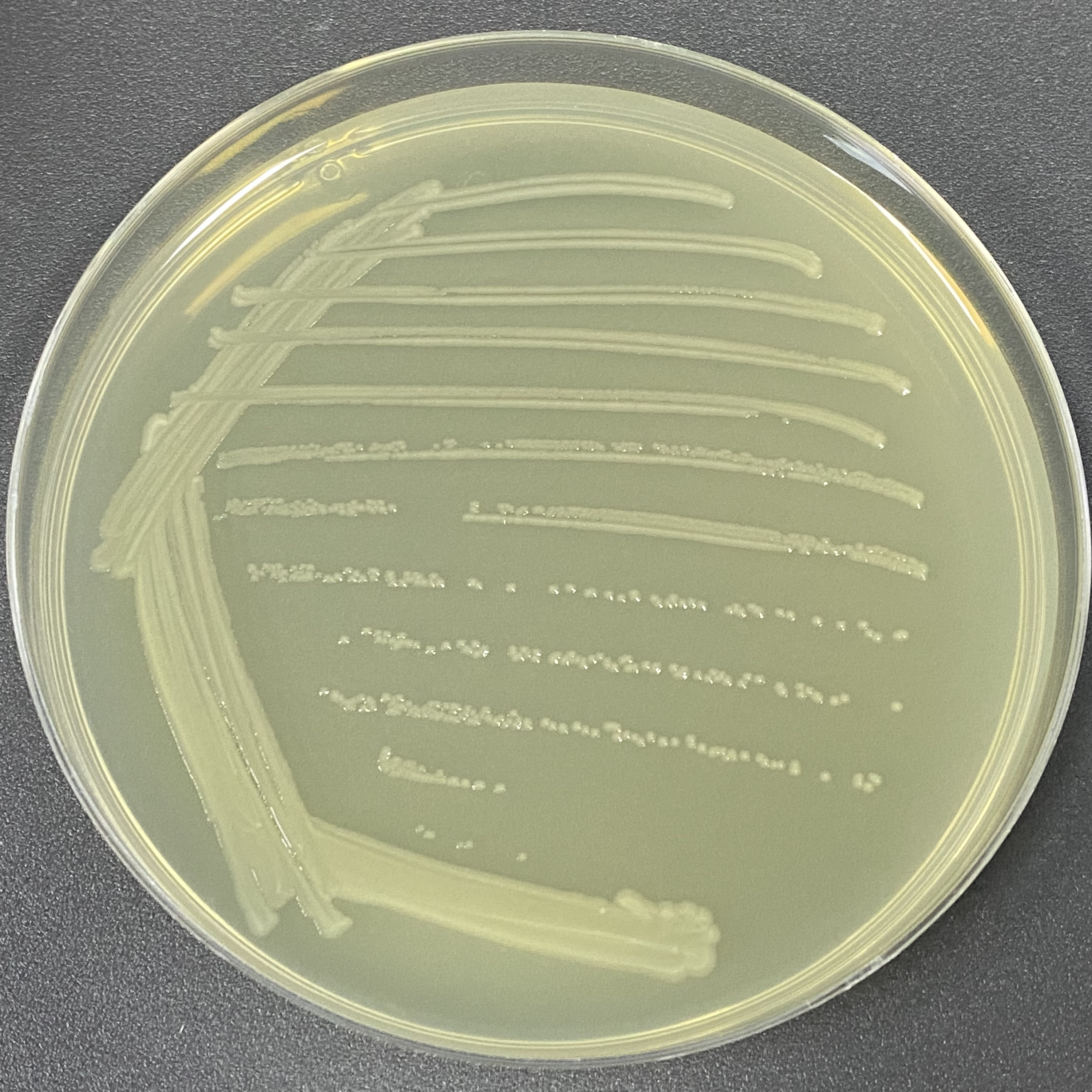 Salmonella enterica subsp. enterica-BNCC