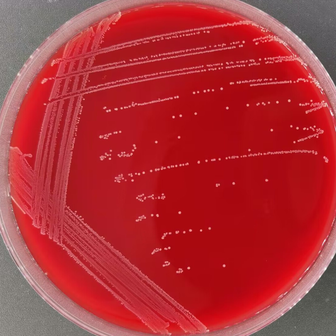 Bacillus subtilis-BNCC