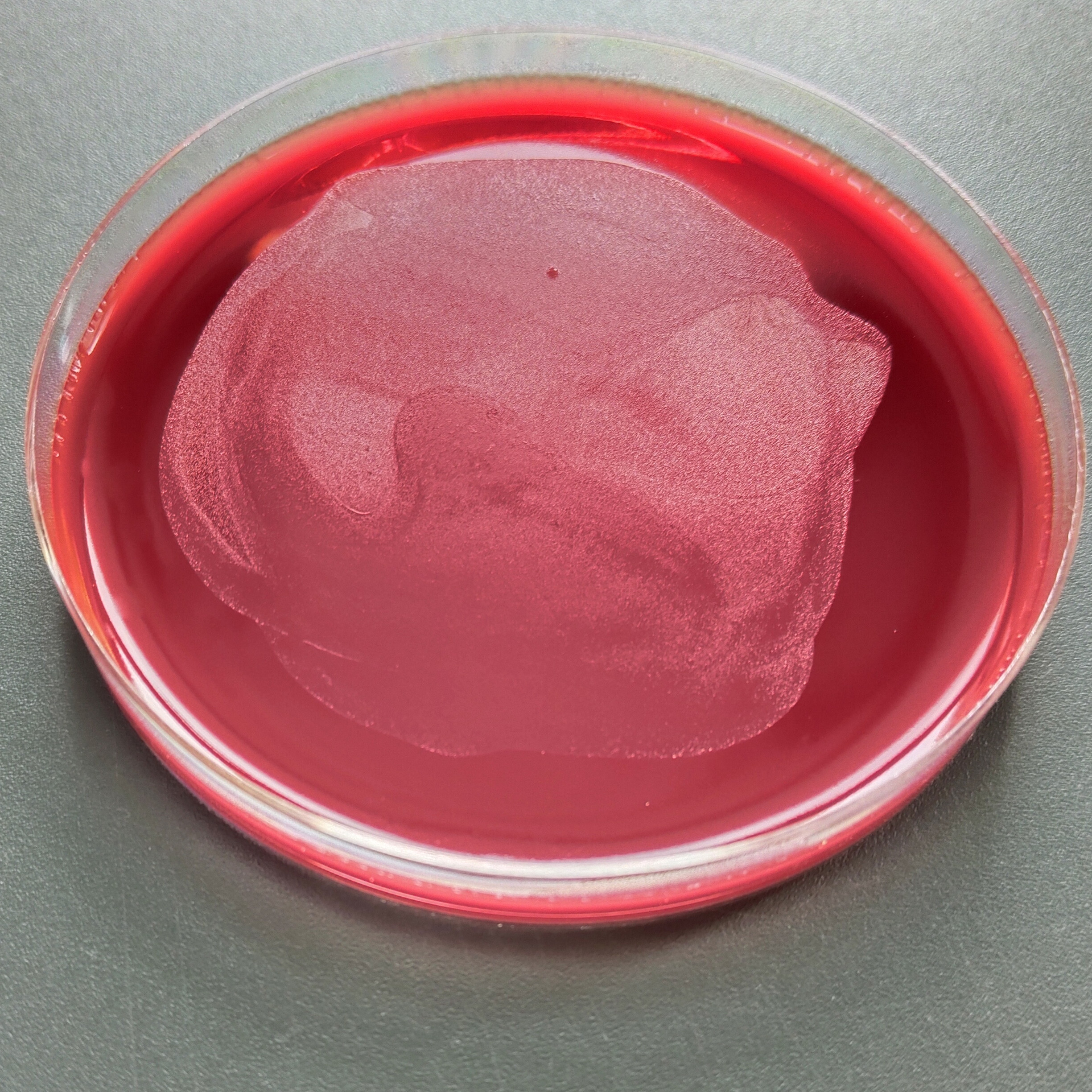 Pseudomonas aeruginosa-BNCC