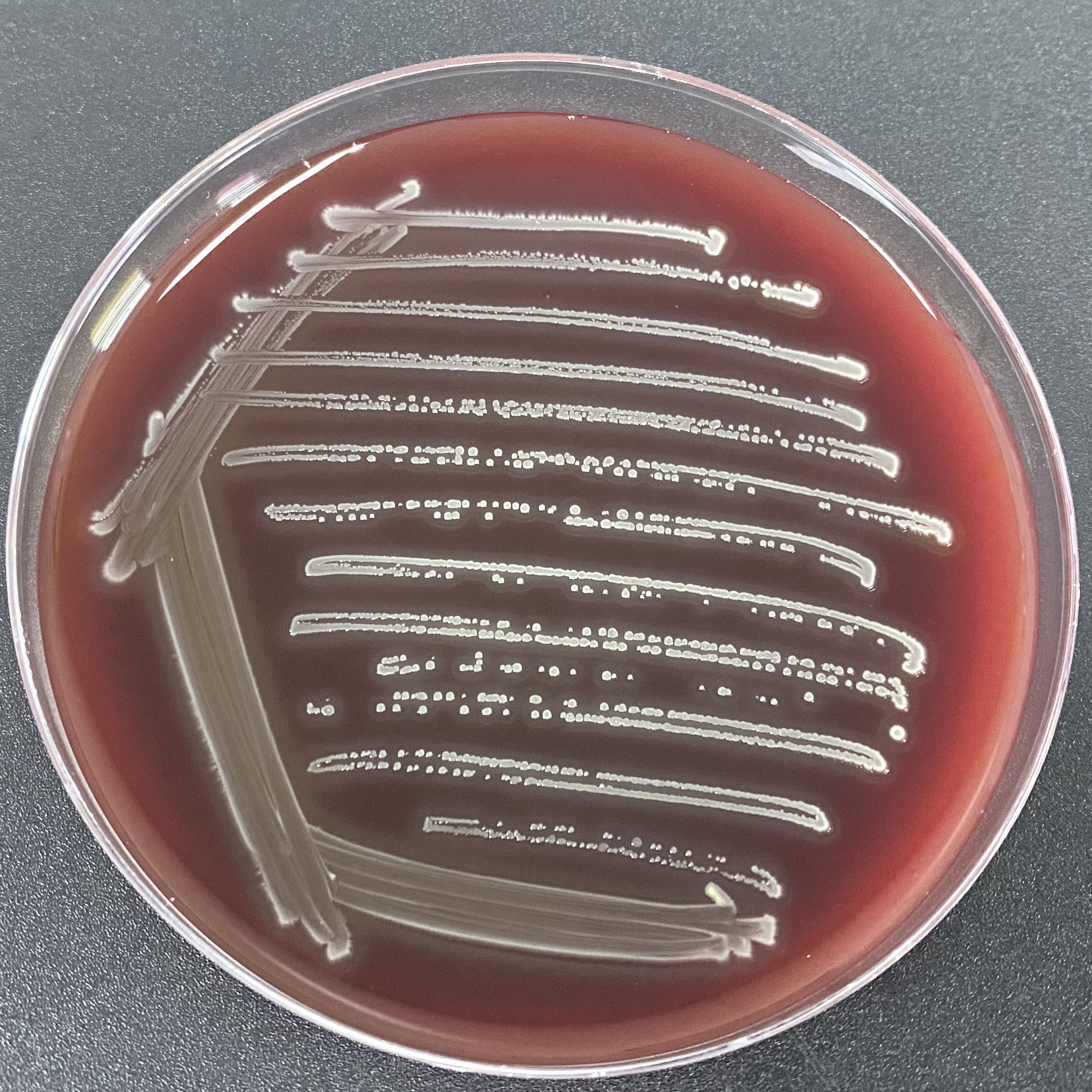 Streptococcus pyogenes-BNCC