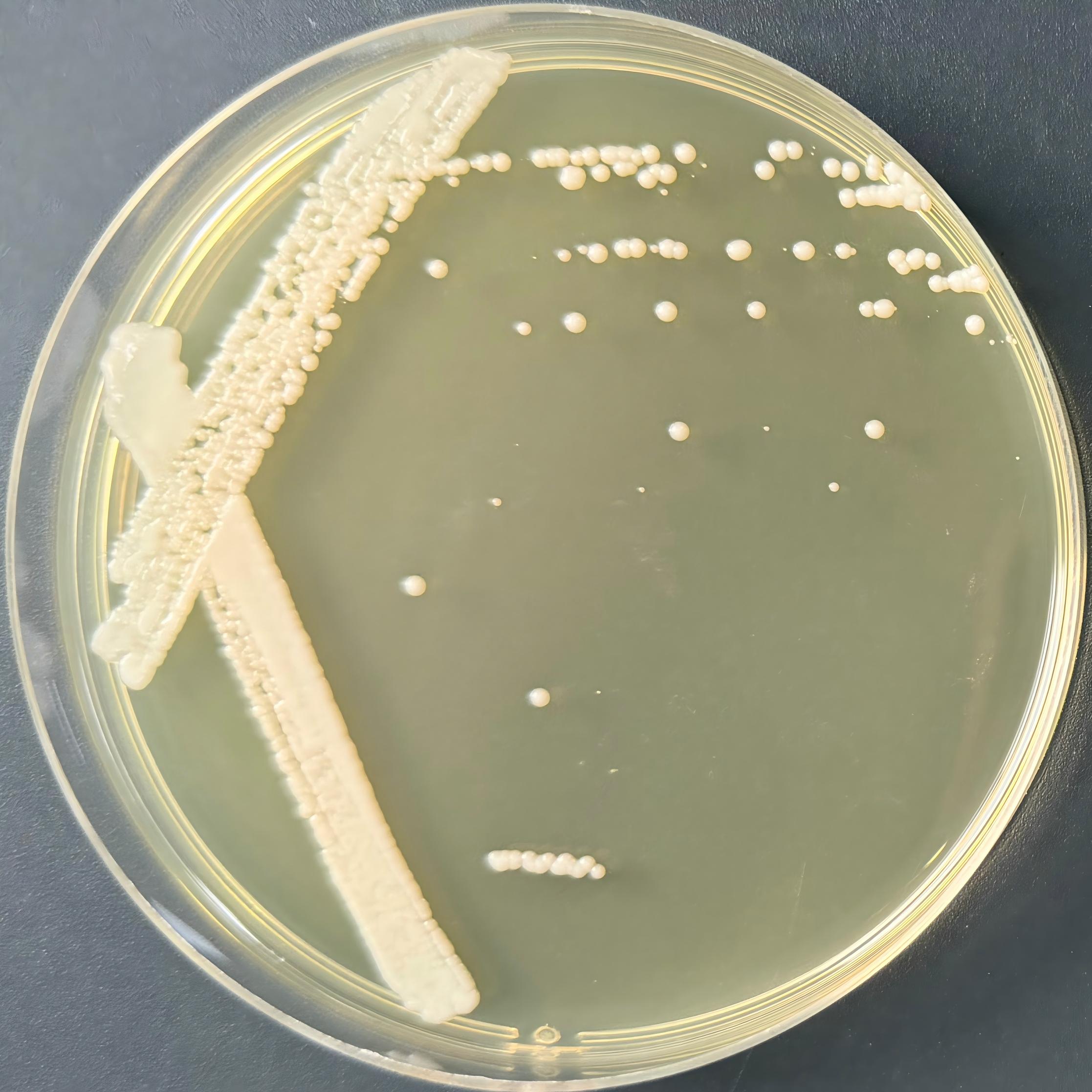 Cryptococcus neoformans-BNCC