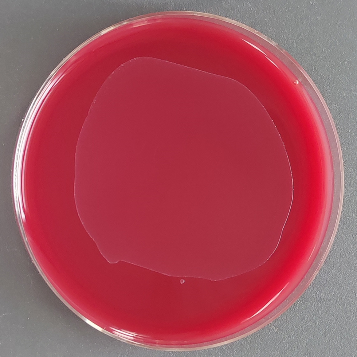 Clostridium perfringens-BNCC