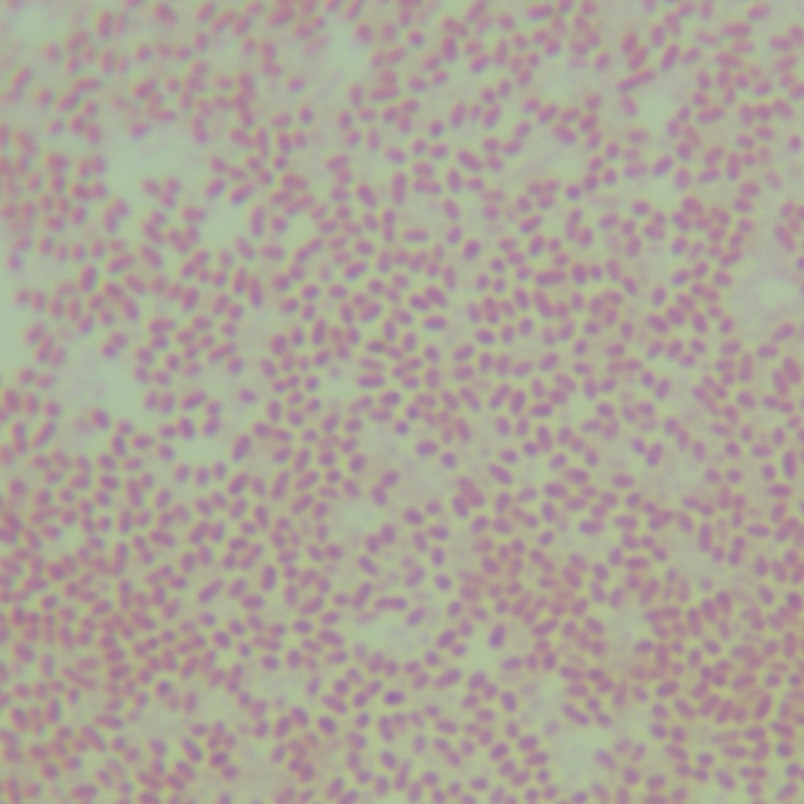 Pseudomonas aeruginosa-BNCC