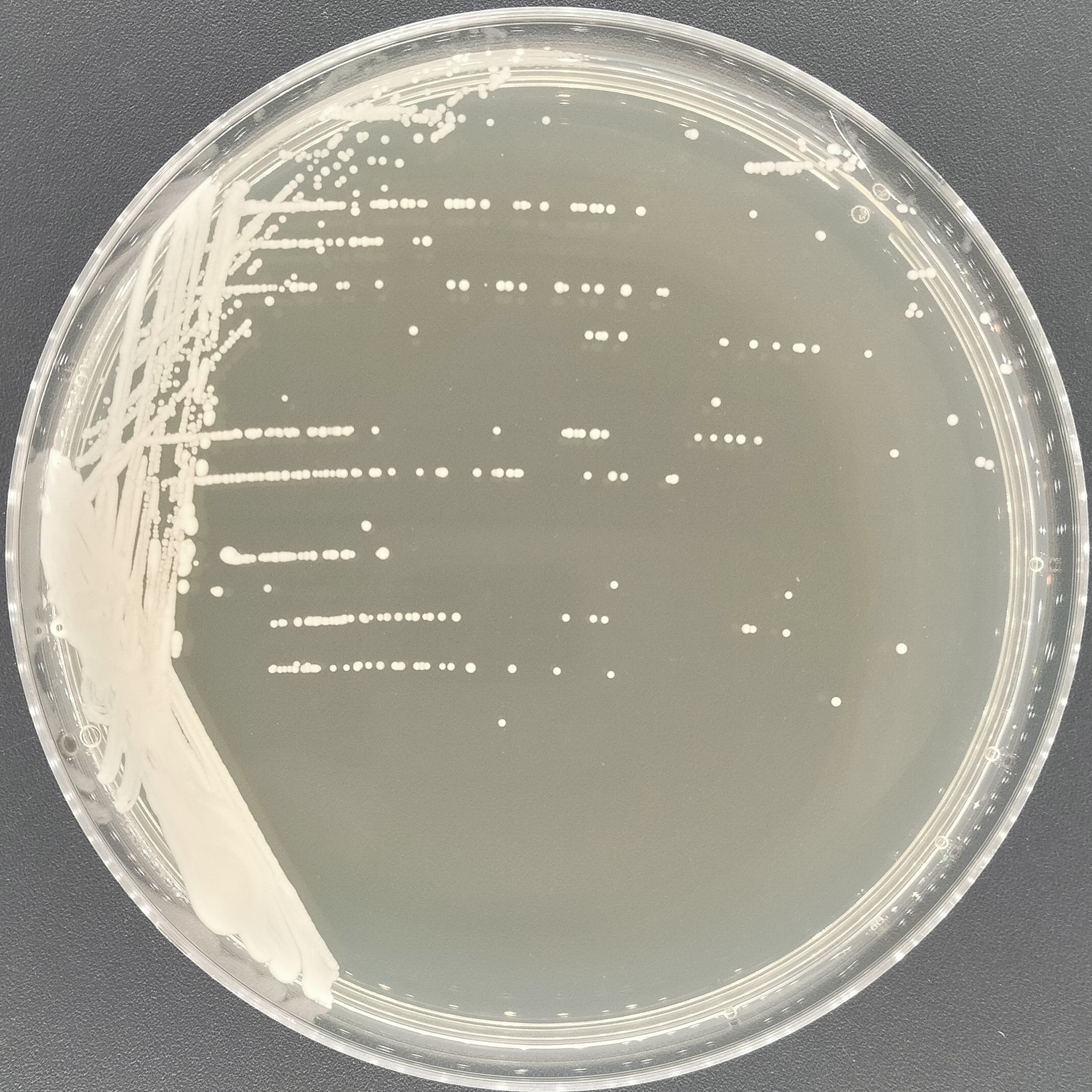 New type of cryptosphere yeast-BNCC