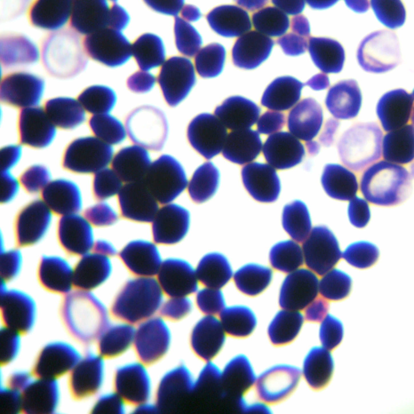 New type of cryptosphere yeast-BNCC
