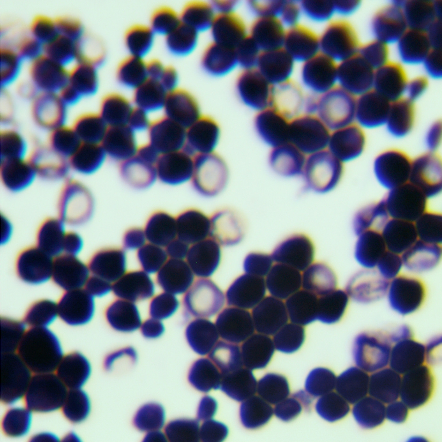 Cryptococcus neoformans-BNCC